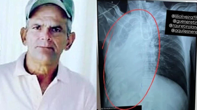 Suposto erro médico em hospital de Retirolândia causa morte de paciente em Feira de Santana